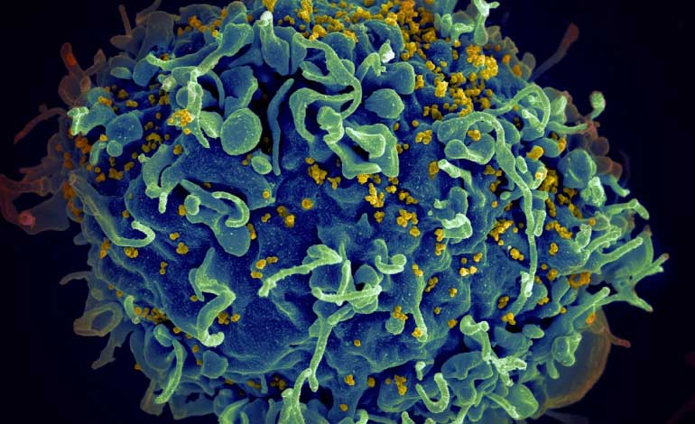 Estados Unidos y su plan para poner fin al VIH en África